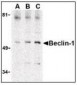 BECN1 / Beclin-1 Antibody (C-Terminus)