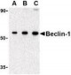 BECN1 / Beclin-1 Antibody (N-Terminus)