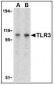 TLR3 Antibody (C-Terminus)