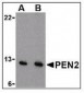 PSENEN / PEN-2 Antibody (N-Terminus)