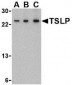 TSLP Antibody (Internal)