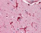 GPX1 / Glutathione Peroxidase Antibody (Internal)