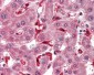 GPX1 / Glutathione Peroxidase Antibody (Internal)