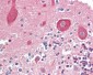 MAP2K1 / MEK1 Antibody (N-Terminus)