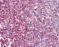 MAP2K1 / MEK1 Antibody (N-Terminus)