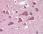 PLA2G16 / HRASLS3 Antibody (N-Terminus)