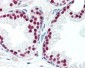 AR / Androgen Receptor Antibody (N-Terminus)