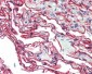 S100A10 Antibody