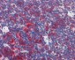 PLIN3 / M6PRBP1 / TIP47 Antibody (Internal)