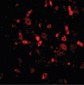 TSLP Antibody (Internal)