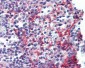 PDGFRB / PDGFR Beta Antibody (clone 42G12)
