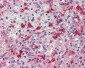 HMOX1 / HO-1 Antibody