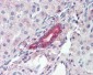 ROR1 Antibody