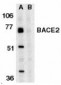 BACE2 Antibody (C-Terminus)
