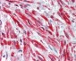 TRIM5 Antibody