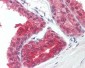 PPARG / PPAR Gamma Antibody (aa170-270, clone 3A4A9, 1E6A1)