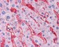 NT5E / eNT / CD73 Antibody (clone 1D7)