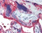 NT5E / eNT / CD73 Antibody (clone 1D7)