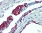 KRT17 / CK17 / Cytokeratin 17 Antibody (C-Terminus, clone V21-R)