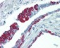 KRT17 / CK17 / Cytokeratin 17 Antibody (C-Terminus, clone V21-R)