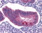 FOXO3 / FOXO3A Antibody (C-Terminus)