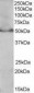 PPARD / PPAR Delta Antibody (C-Terminus)