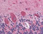 GAD65 Antibody (Internal)