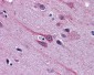 GBX2 Antibody (Internal)