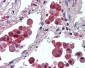 IDE Antibody (Internal)