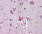 NODAL Antibody (Internal)
