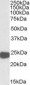 PRDX1 / Peroxiredoxin 1 Antibody (Internal)