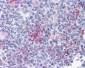 FCER2 / CD23 Antibody (clone EBVCS2)
