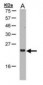 ARL2 Antibody