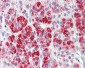 CLTC / Clathrin Heavy Chain Antibody (Internal)