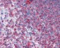 ACTG1 / Gamma Actin Antibody
