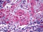ACTG1 / Gamma Actin Antibody