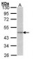 ACTG1 / Gamma Actin Antibody