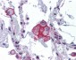 VRL1 / TRPV2 Antibody