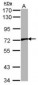 VRL1 / TRPV2 Antibody