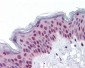 TIP48 / RUVBL2 Antibody