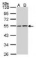 TIP48 / RUVBL2 Antibody