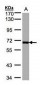 PLK1 / PLK-1 Antibody