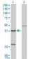 CTSK / Cathepsin K Antibody (clone 2F1)