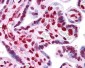 HMG1 / HMGB1 Antibody (clone 2F6)