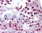 HMG1 / HMGB1 Antibody (clone 2F6)