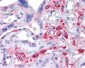 SLC7A11 / XCT Antibody (Internal)