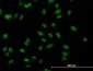 MBNL1 / MBNL Antibody (clone 3E7)