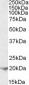 FTL / Ferritin Light Chain Antibody (C-Terminus)