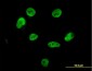 HNRPM / HNRNPM Antibody (clone 3F7)