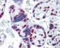 HNRPM / HNRNPM Antibody (clone 3F7)